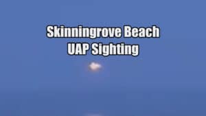 skinningrove UAP